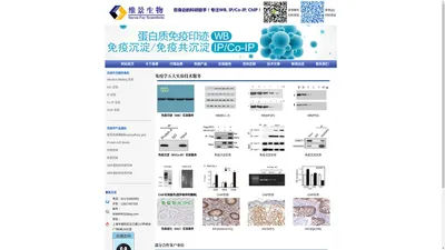 免疫组化IHC，免疫印迹WB，免疫沉淀IP，免疫共沉淀Co-IP，染色质免疫共沉淀ChIP,内参抗体，标签抗体，标签抗体偶联agarose beads，标签抗体affinity gel，M2 affinity gel，anti FLAG affinity gel，anti HA affinity gel，anti Myc affinity gel！--上海维景生物科技有限公司