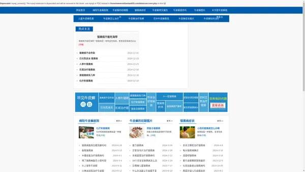 成都牛皮癣专科医院_成都牛皮癣医院哪家好_成都治疗牛皮癣的医院_成都银康银屑病医院